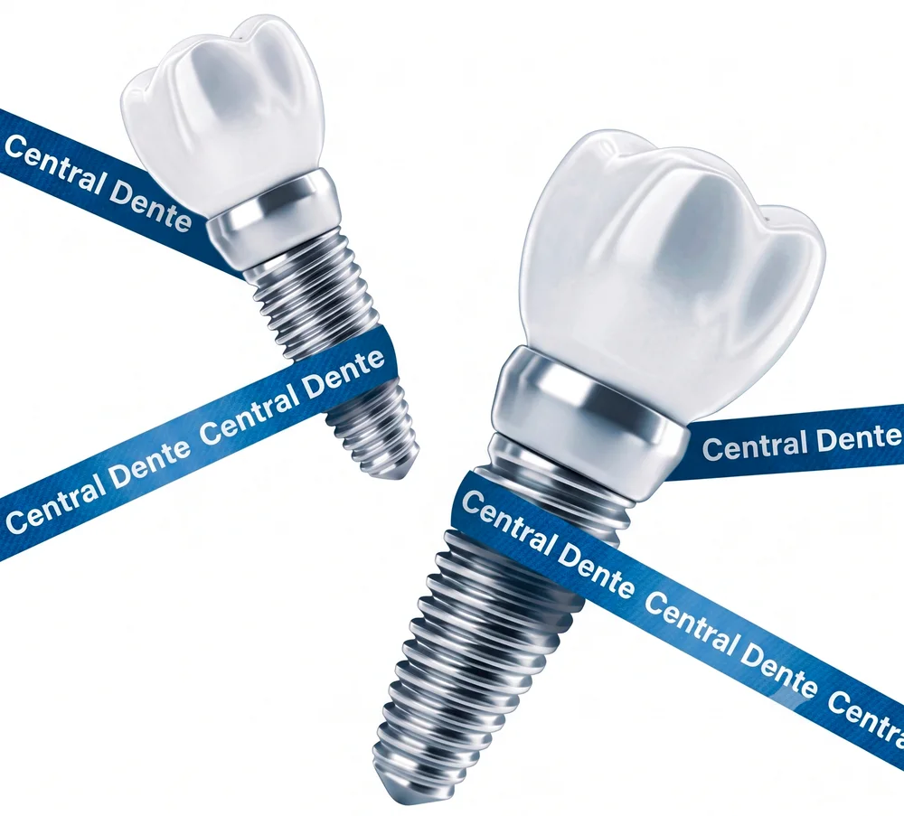 Implantes dentários com a marca Central Dente